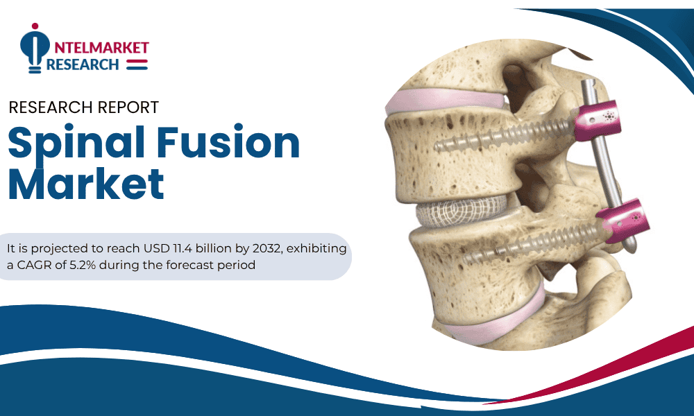 Spinal Fusion Market
